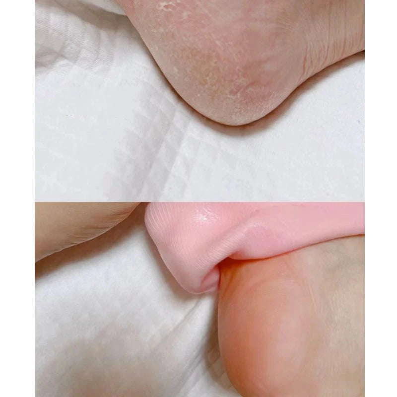 Reusable Hand & Feet Care Mask